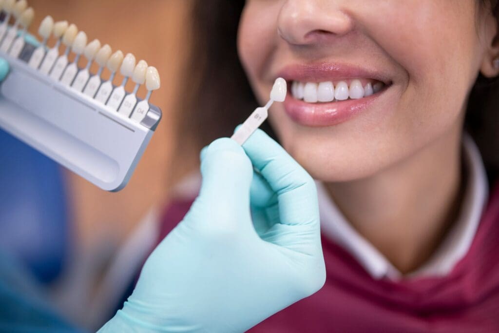 Porcelain Veneers in Charlotte, NC